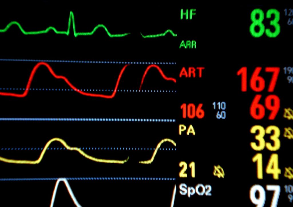 Hreat monitor